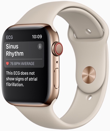 news-iphone-xs-apple-watch news-iphone-xs-apple-watch