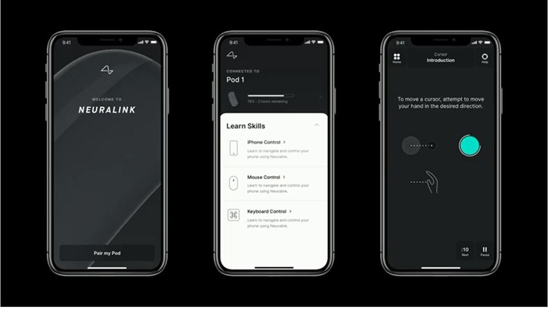 Bci Neuralink Smartphone App