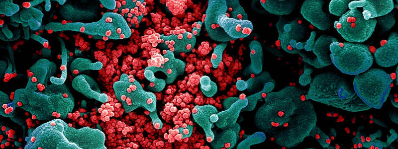 Foldingathome Covidprotein