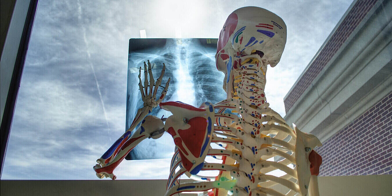 News Calneo X Ray Featured