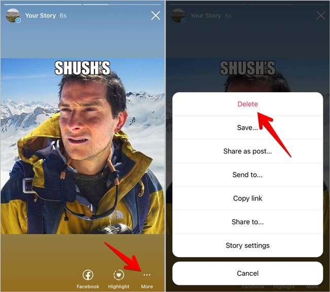 Instagram Delete Photo Story