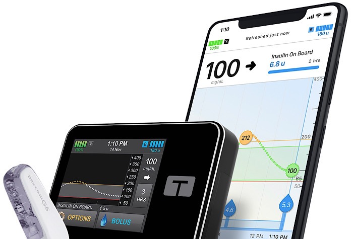 Mobile App Insulin Pump