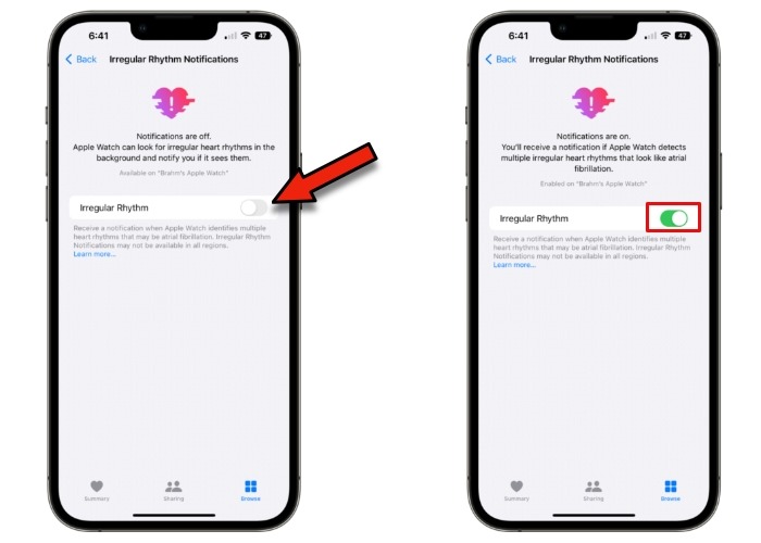 Iphone Irregular Rhythm Toggle