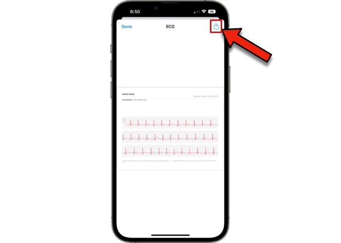 Watch Ecg Export Pdf