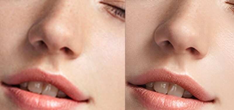 Aiarty Image Enhancer Lips Example